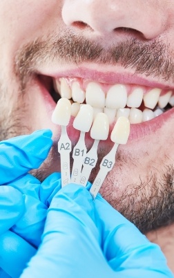 Dental patient's smile compared with dental restoration shade options