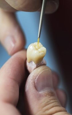 Dental lab technician sealing a dental crown