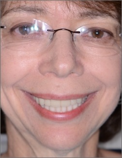 Woman smiling after tooth replacement and cosmetic dentistry