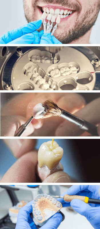 Collage of images from the in house dental lab in Vienna