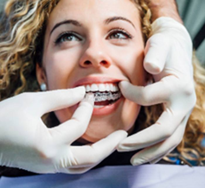 Woman smiling while dentist places Invisalign on her teeth