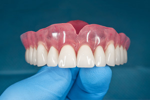 Close-up of a gloved hand holding full dentures